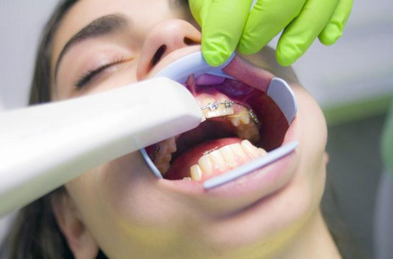brookmeredental_5_orthodontic_treatment_benefits