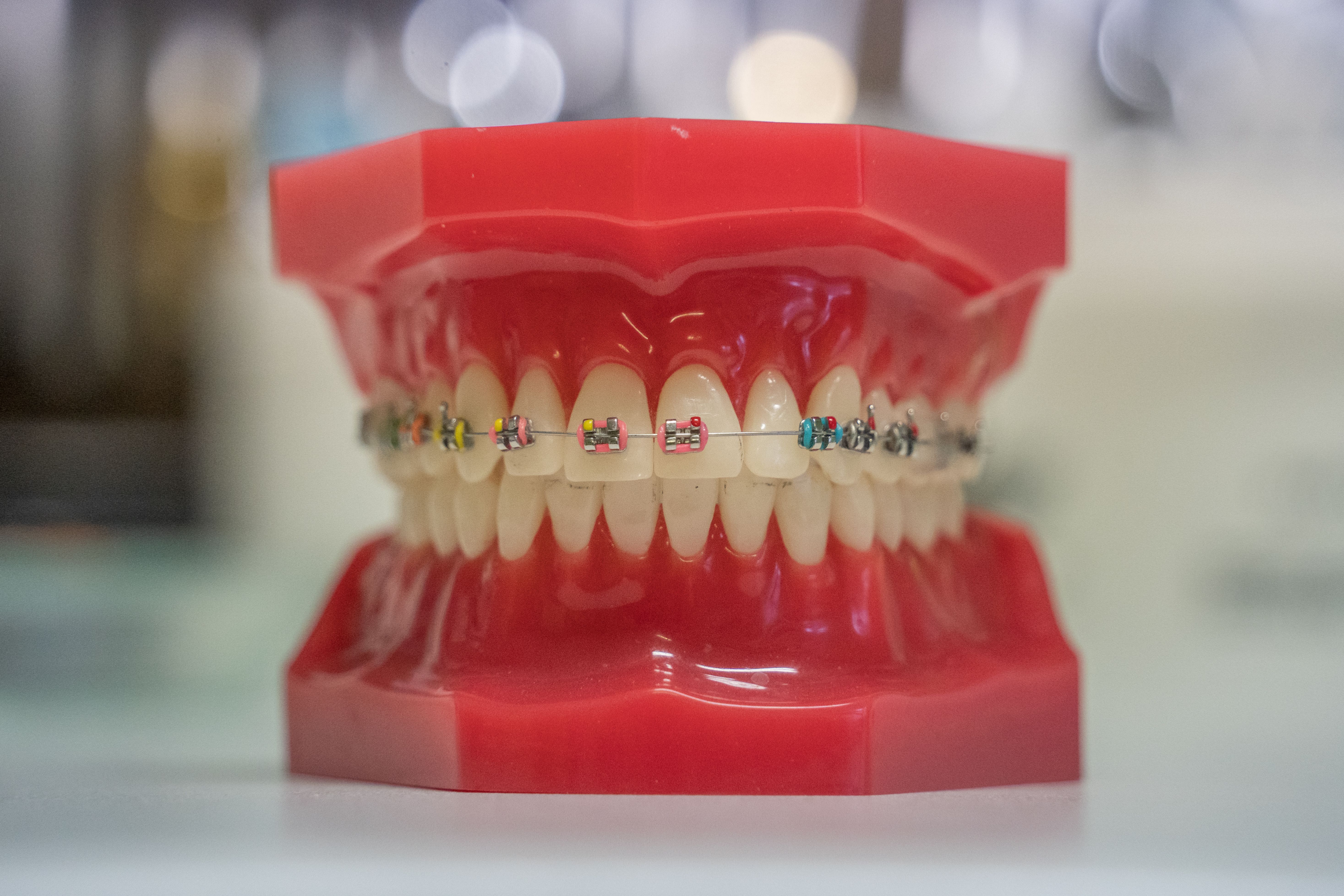 Orthodontic Treatment Benefits