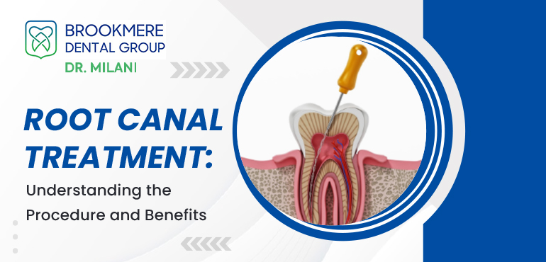 Root Canal Treatment: Understanding the Procedure and Benefits