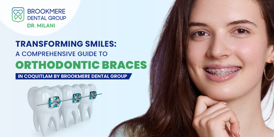 Transforming Smiles: A Comprehensive Guide to Orthodontic Braces in Coquitlam by Brookmere Dental Group