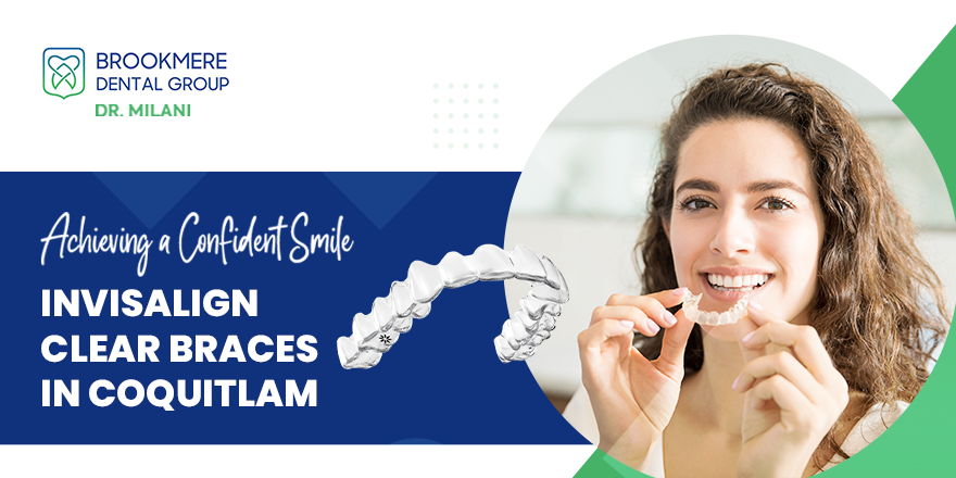Achieving a Confident Smile with Invisalign Clear Braces in Coquitlam