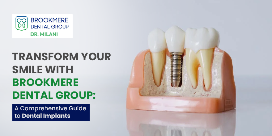 Comprehensive Guide to Dental Implants