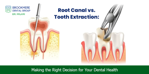 Root Canal vs. Tooth Extraction