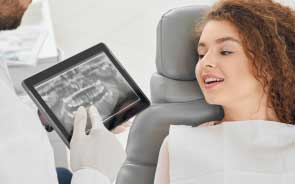 Dental-Implants