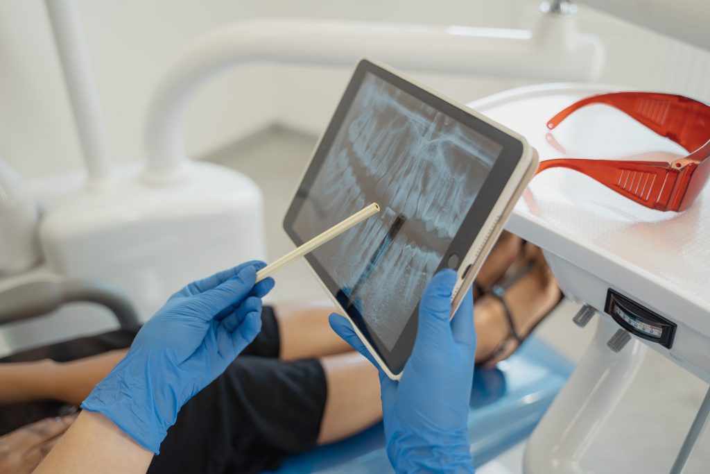 Are Dental Implants Right for You