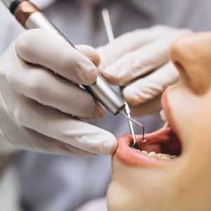 brookmeredental-blog-how-to-solve-your-5-most-common-dental-problems